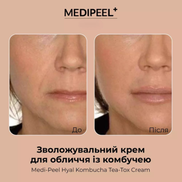 Оптом Зволожувальний крем для обличчя із комбучею MEDIPEEL HYAL KOMBUCHA TEA-TOX CREAM - 50 мл
