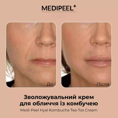 Оптом Зволожувальний крем для обличчя із комбучею MEDIPEEL HYAL KOMBUCHA TEA-TOX CREAM - 50 мл