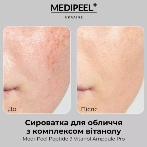 Оптом Сироватка для обличчя з комплексом вітанолу MEDIPEEL PEPTIDE 9 VITANOL AMPOULE PRO - 30 мл