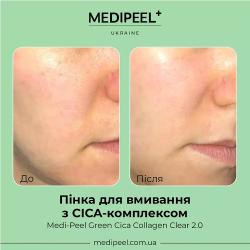 Оптом Очищаючий гель для обличчя з колагеном MEDIPEEL GREEN CICA COLLAGEN CLEAR GEL CLEANSER 2.0 - 300 мл