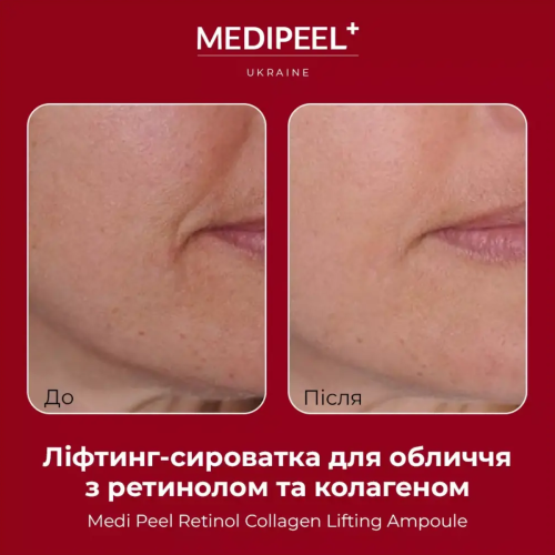 Оптом Ліфтинг-сироватка для обличчя з ретинолом та колагеном MEDIPEEL RETINOL COLLAGEN LIFTING AMPOULE - 50 мл